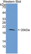 Toll Like Receptor 3 (TLR3) Human Monoclonal Antibody