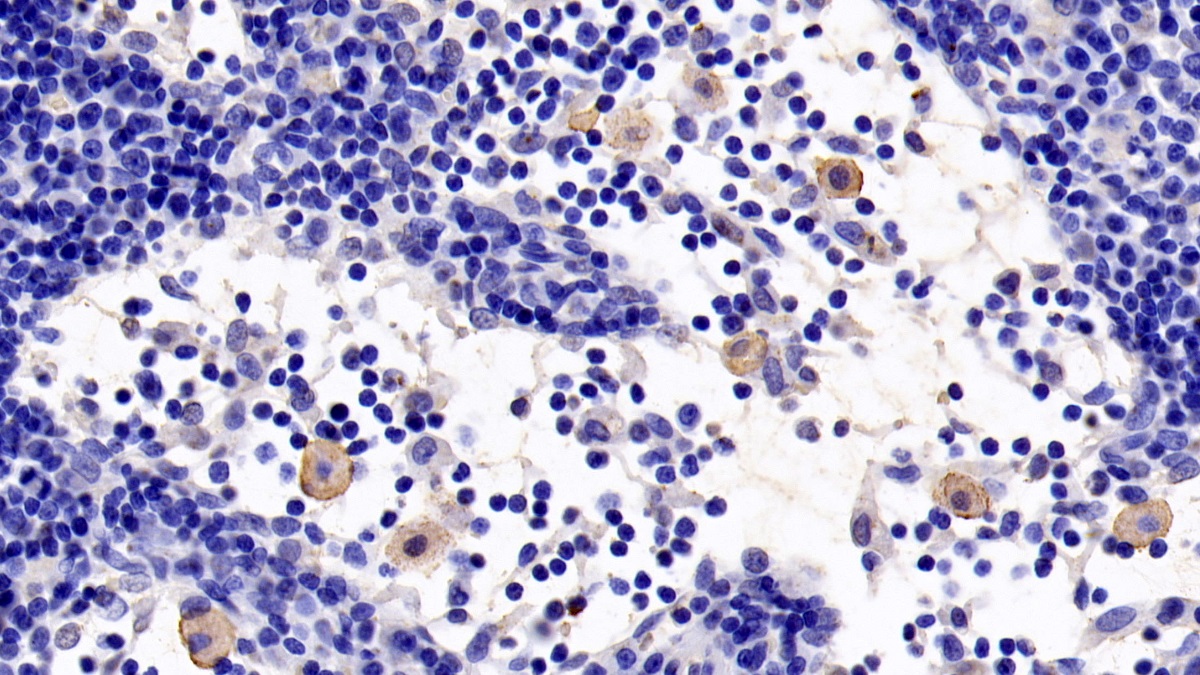 Toll Like Receptor 5 (TLR5) Human Monoclonal Antibody