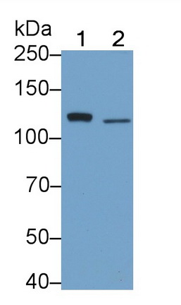 Toll Like Receptor 5 (TLR5) Human Monoclonal Antibody