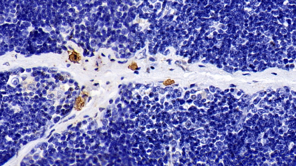 Toll Like Receptor 5 (TLR5) Human Monoclonal Antibody