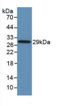 Toll Like Receptor 8 (TLR8) Human Monoclonal Antibody