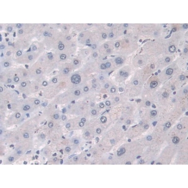 Hemojuvelin (HJV) Human Monoclonal Antibody