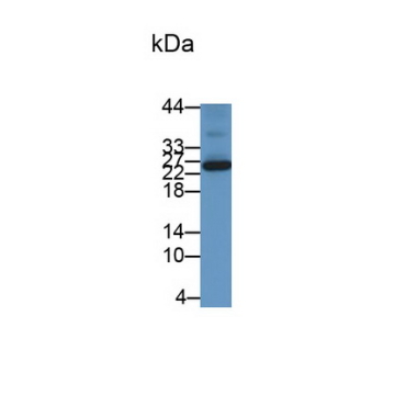 Hemojuvelin (HJV) Human Monoclonal Antibody