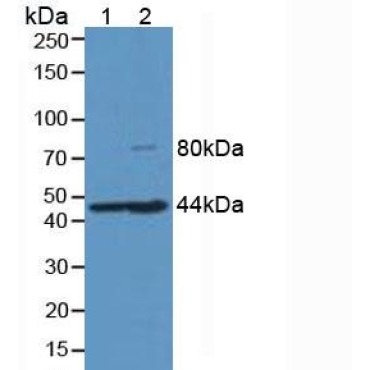 Hemojuvelin (HJV) Human Monoclonal Antibody