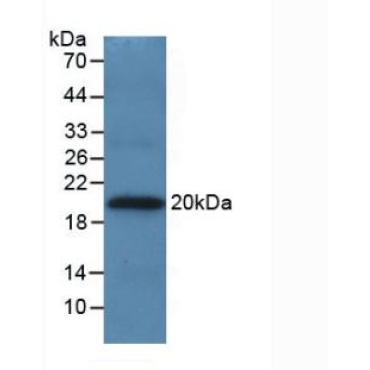 Apolipoprotein A5 (APOA5) Human Monoclonal Antibody