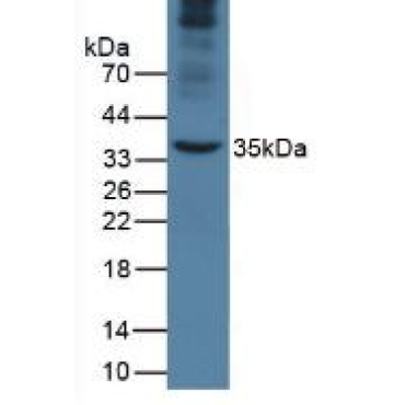 Apolipoprotein A5 (APOA5) Mouse Monoclonal Antibody