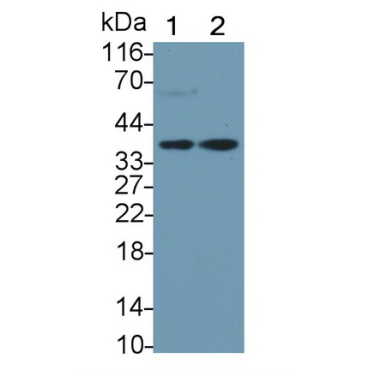 Haptoglobin Related Protein (HPR) Human Monoclonal Antibody