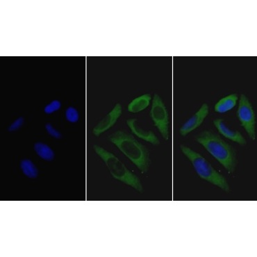Haptoglobin Related Protein (HPR) Human Monoclonal Antibody