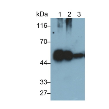 Haptoglobin Related Protein (HPR) Human Monoclonal Antibody