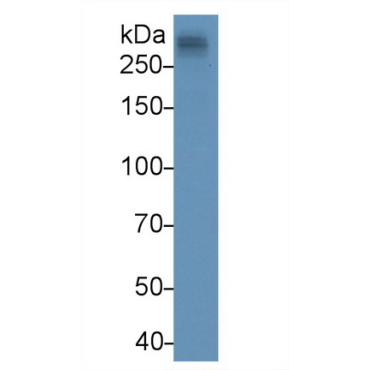 Apolipoprotein B (APOB) Human Monoclonal Antibody