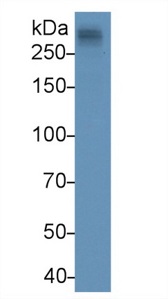 Apolipoprotein B (APOB) Human Monoclonal Antibody