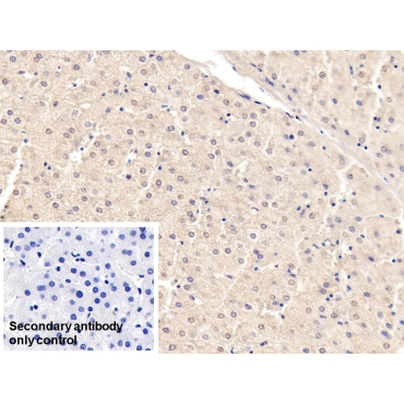 Apolipoprotein B (APOB) Human Monoclonal Antibody