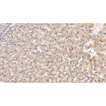 Apolipoprotein B (APOB) Human Monoclonal Antibody