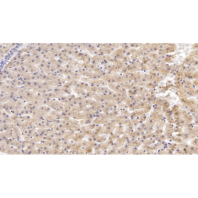 Apolipoprotein B (APOB) Human Monoclonal Antibody