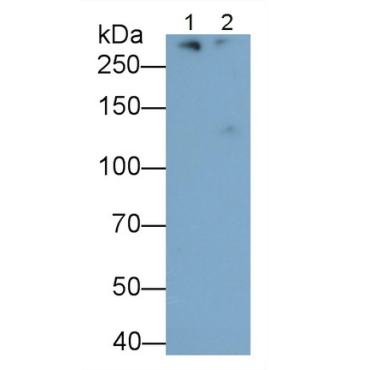Apolipoprotein B (APOB) Mouse Monoclonal Antibody