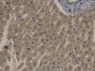 Apolipoprotein B (APOB) Rat Monoclonal Antibody