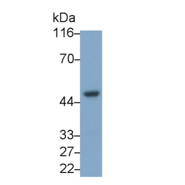 Interleukin 8 Receptor Beta (IL8Rb) Human Monoclonal Antibody