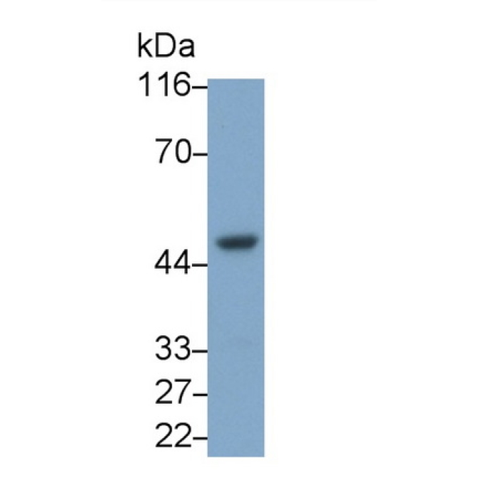 Interleukin 8 Receptor Beta (IL8Rb) Human Monoclonal Antibody