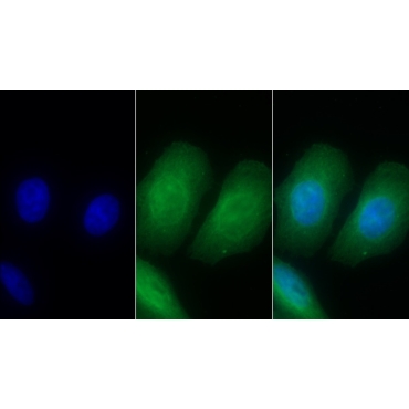 Interleukin 8 Receptor Beta (IL8Rb) Human Monoclonal Antibody