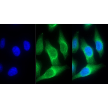 Interleukin 8 Receptor Beta (IL8Rb) Human Monoclonal Antibody