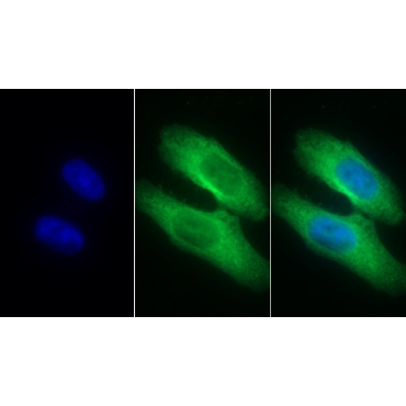 Interleukin 8 Receptor Beta (IL8Rb) Human Monoclonal Antibody
