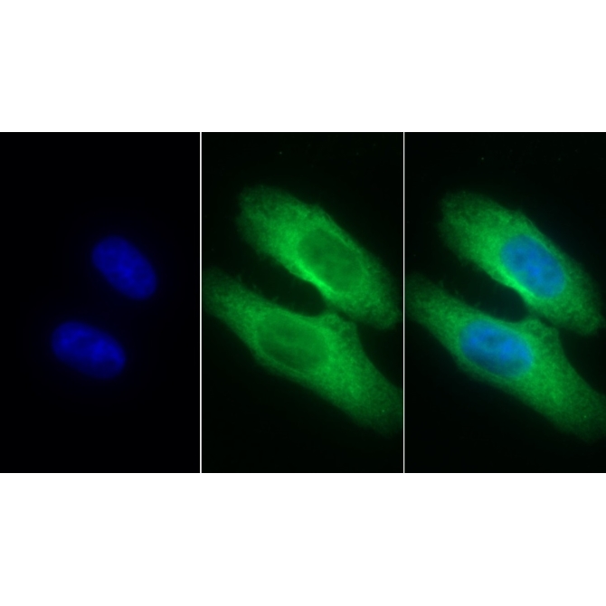 Interleukin 8 Receptor Beta (IL8Rb) Human Monoclonal Antibody