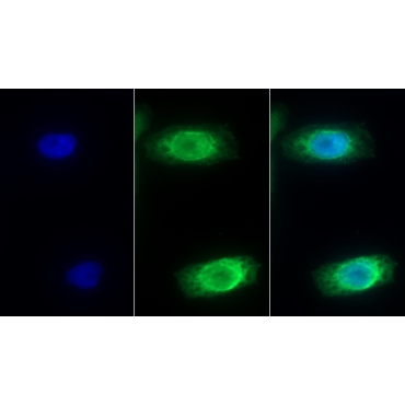 Interleukin 8 Receptor Beta (IL8Rb) Human Monoclonal Antibody