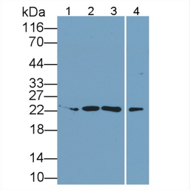 Interleukin 34 (IL34) Human Monoclonal Antibody