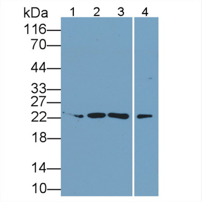 Interleukin 34 (IL34) Human Monoclonal Antibody