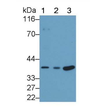 Interleukin 34 (IL34) Human Monoclonal Antibody