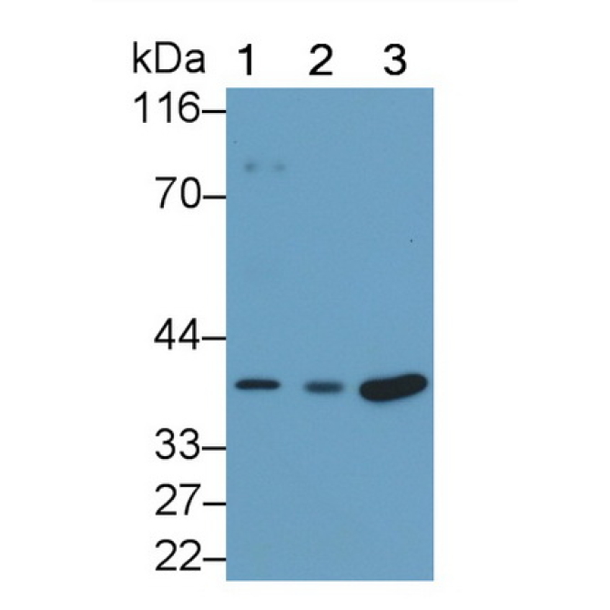 Interleukin 34 (IL34) Human Monoclonal Antibody