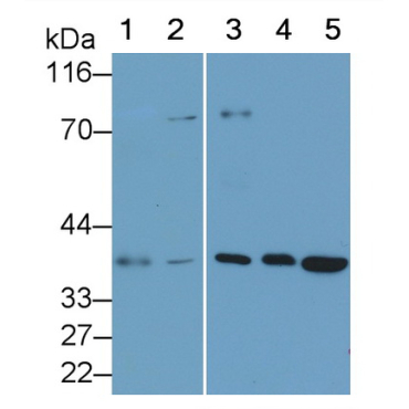 Interleukin 34 (IL34) Human Monoclonal Antibody