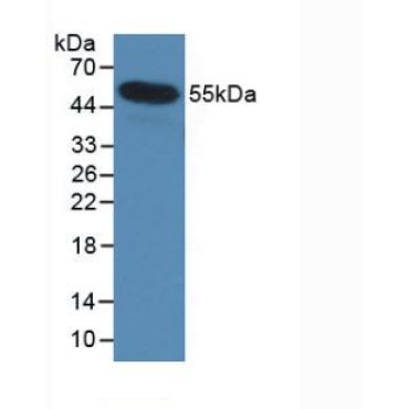 Interleukin 35 (IL35) Human Monoclonal Antibody