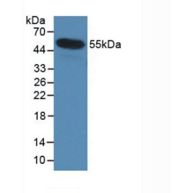 Interleukin 35 (IL35) Human Monoclonal Antibody