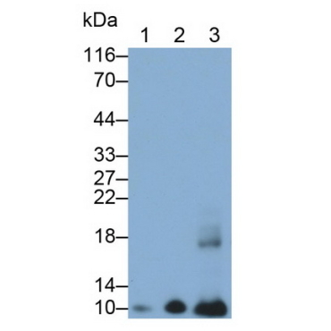 S100 Calcium Binding Protein A2 (S100A2) Human Monoclonal Antibody