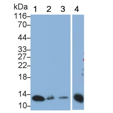 S100 Calcium Binding Protein A2 (S100A2) Human Monoclonal Antibody