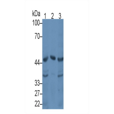 Serpin A10 (SERPINA10) Human Monoclonal Antibody