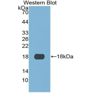 S100 Calcium Binding Protein A3 (S100A3) Human Monoclonal Antibody