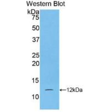 S100 Calcium Binding Protein A5 (S100A5) Human Monoclonal Antibody