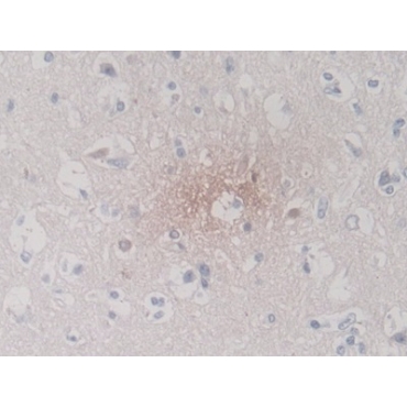 S100 Calcium Binding Protein A5 (S100A5) Human Monoclonal Antibody