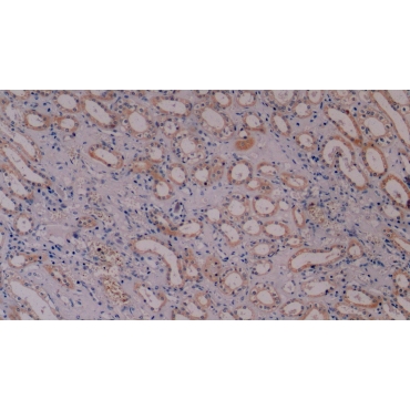 Cytokeratin 8 (CK8) Human Monoclonal Antibody