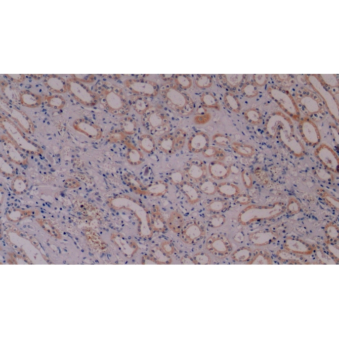 Cytokeratin 8 (CK8) Human Monoclonal Antibody