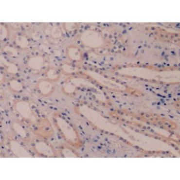 Cytokeratin 8 (CK8) Human Monoclonal Antibody
