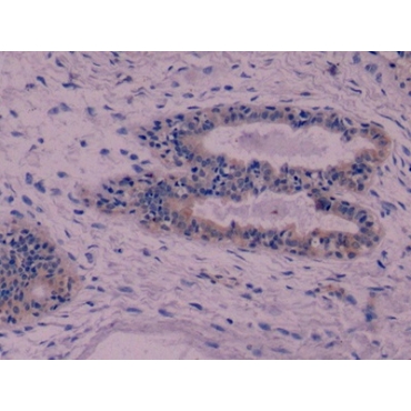 Cytokeratin 8 (CK8) Human Monoclonal Antibody