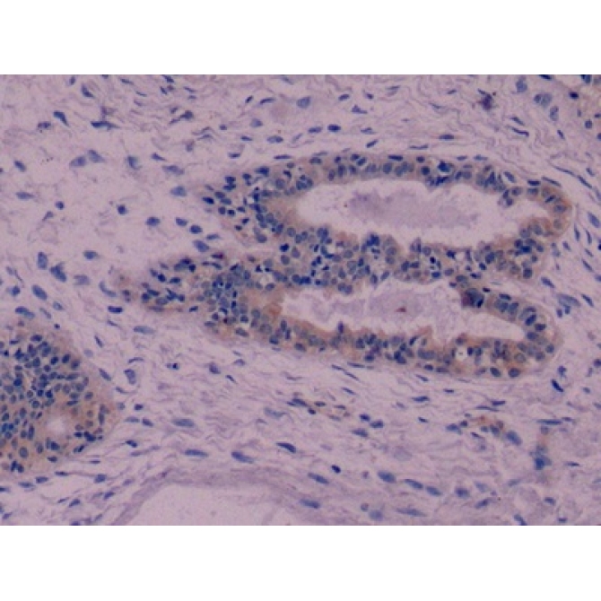 Cytokeratin 8 (CK8) Human Monoclonal Antibody