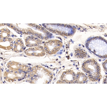 Interleukin 29 (IL29) Human Monoclonal Antibody