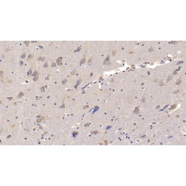 Interleukin 29 (IL29) Human Monoclonal Antibody