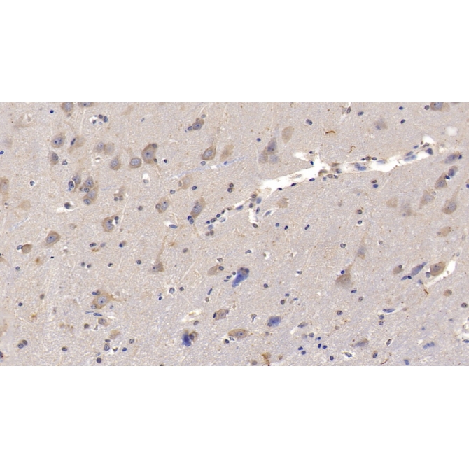 Interleukin 29 (IL29) Human Monoclonal Antibody