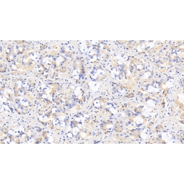 Interleukin 29 (IL29) Human Monoclonal Antibody