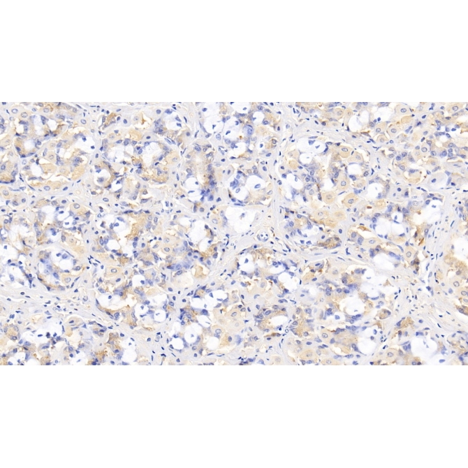 Interleukin 29 (IL29) Human Monoclonal Antibody